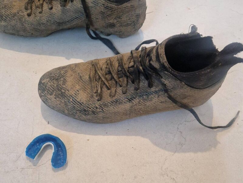 "Nothing, and I mean nothing causes more chaos in my house than mouthguards."