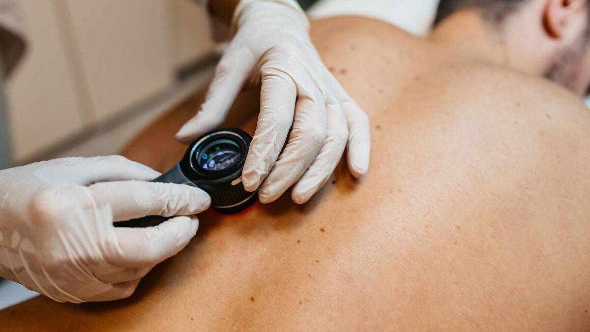 Free skin cancer screening in Cork city centre hospital tomorrow morning