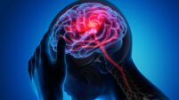 Man with brain stroke symptoms