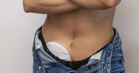 ASHLEY - 130724 065.JPG East Cork town to roll out pilot scheme in public toilets for colostomy bag users