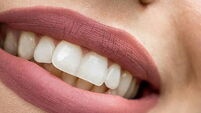HPRA issues safety warning to consumers on teeth whitening products