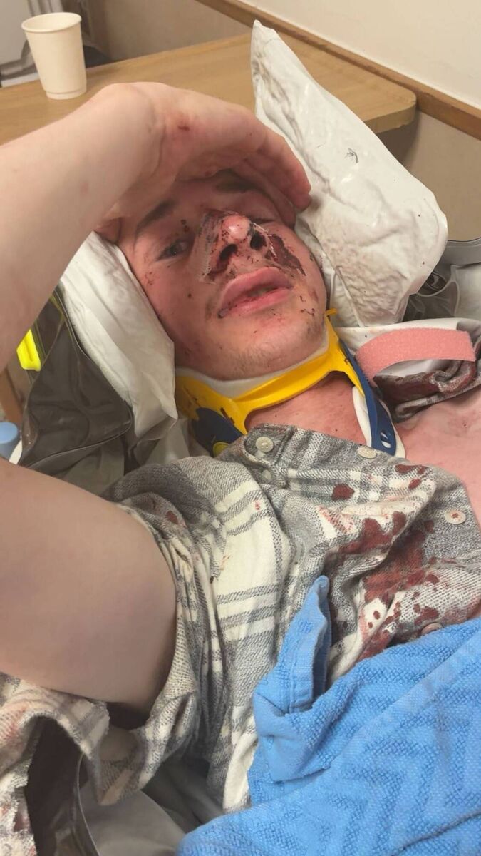 Shane McCarthy, who was attacked in Mahon with his brother Logan.