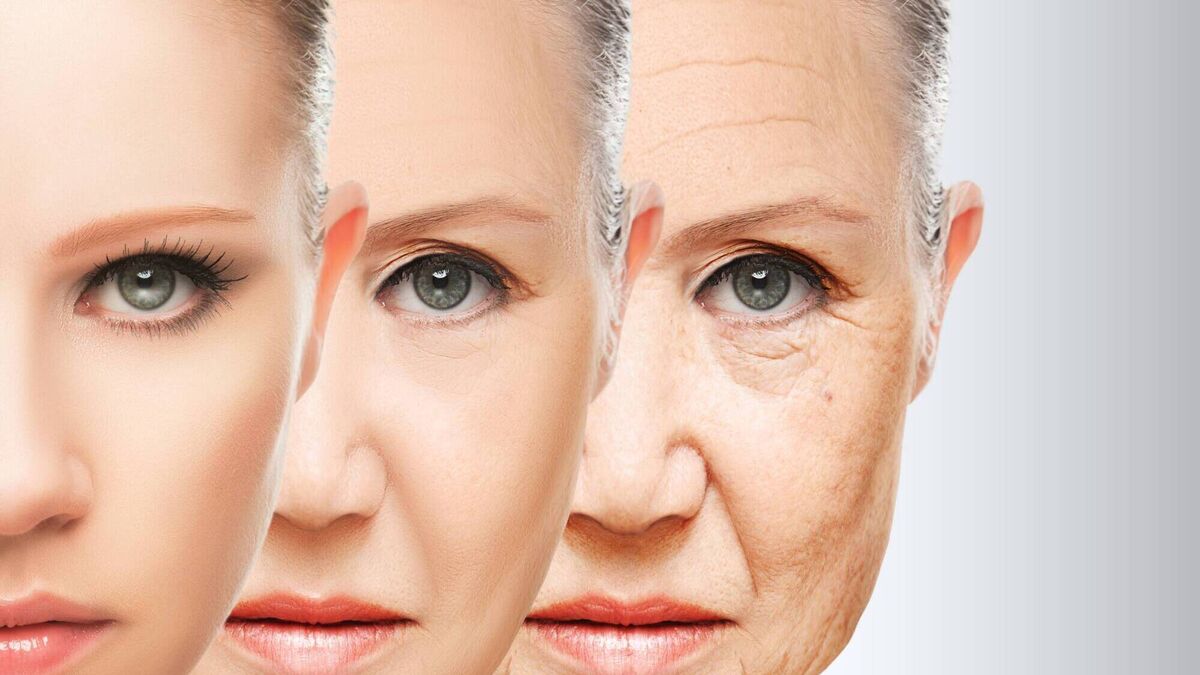 Áilín Quinlan: The mirror showed an unexpected abundance of wrinkles...did I want Botox?