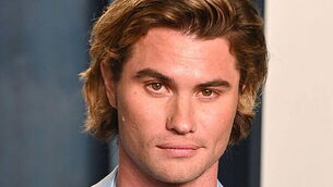 Outer Banks’ Chase Stokes suffers short-term memory loss from on-set injuries Outer Banks’ Chase Stokes suffers short-term memory loss from on-set injuries