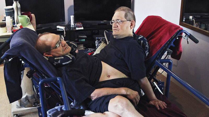 Brother pays tribute after death of world’s longest-surviving conjoined twins Brother pays tribute after death of world’s longest-surviving conjoined twins