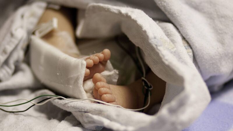 Newborns who suffer mild oxygen deprivation at birth can suffer neurological damage, UCC research shows 