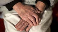 Dementia and Alzheimer's disease leading cause of death