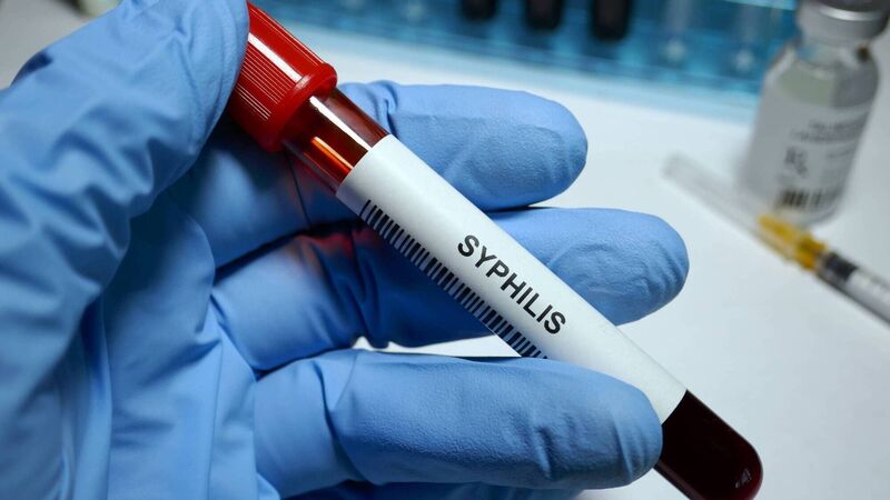 Cork GP warning as the number of syphilis cases doubles  Cork GP warning as the number of syphilis cases doubles