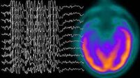 I have epilepsy but life’s still full of potential