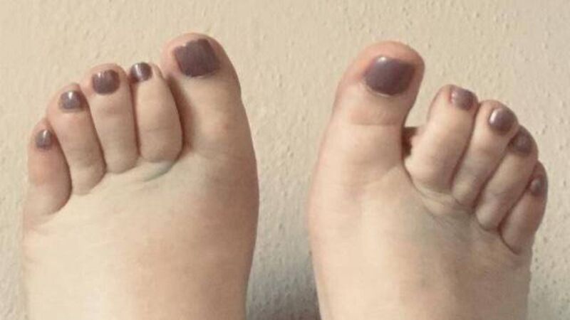 Patients are living without basic treatment