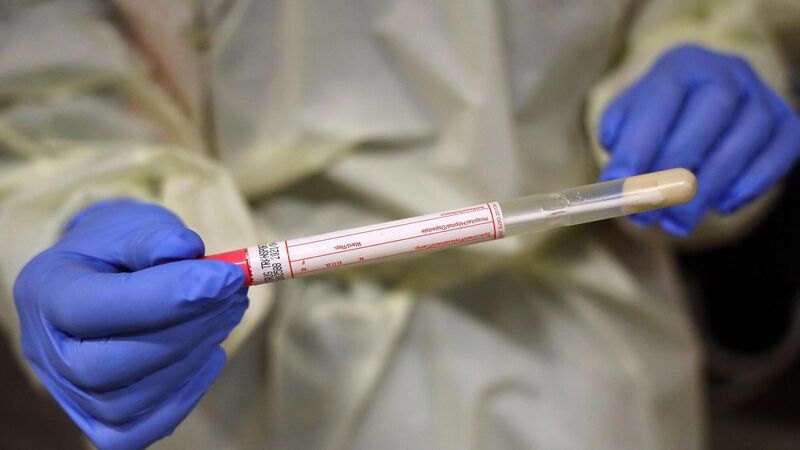 Cases of South African Covid-19 variant discovered in Ireland Cases of South African Covid-19 variant discovered in Ireland