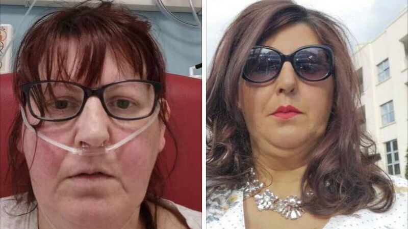 Cork patient who was 'drowning from Covid' says public 'don't know how bad it is' from her hospital bed Cork patient who was 'drowning from Covid' says public 'don't know how bad it is' from her hospital bed
