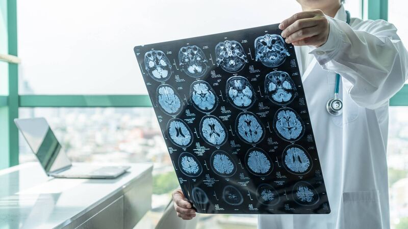 Dr Michelle O'Driscoll: Recognising a stroke early is vital Dr Michelle O'Driscoll: Recognising a stroke early is vital