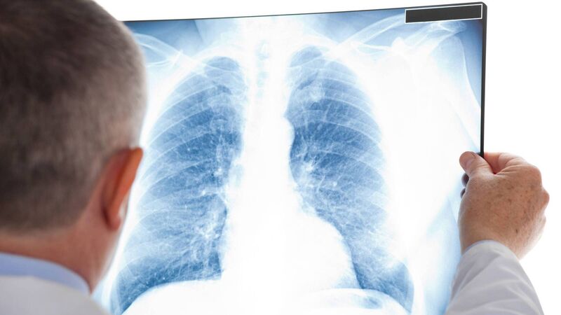 Dr Michelle O'Driscoll: Lung cancer kills 1,800 in Ireland every year