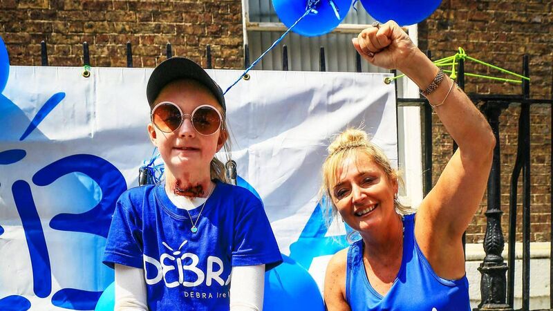 Mother who contracted Covid-19 and was unable to care for daughter with EB describes 'worst nightmare' Mother who contracted Covid-19 and was unable to care for daughter with EB describes 'worst nightmare'