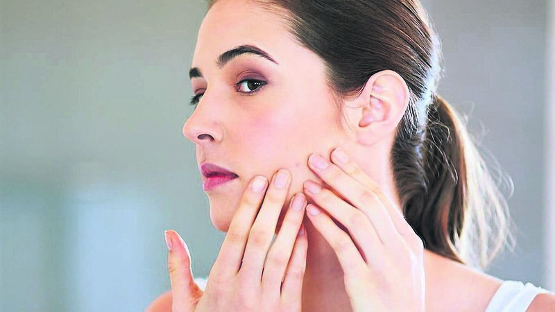 Challenging myths about acne