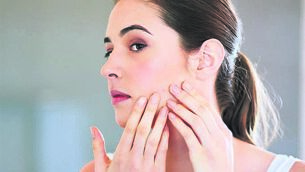 <p>Acne occurs when pores in the skin get blocked by dead skin cells and sebum or oil. This is coupled with the growth of bacteria, causing the skin to become inflamed. Picture Stock</p>