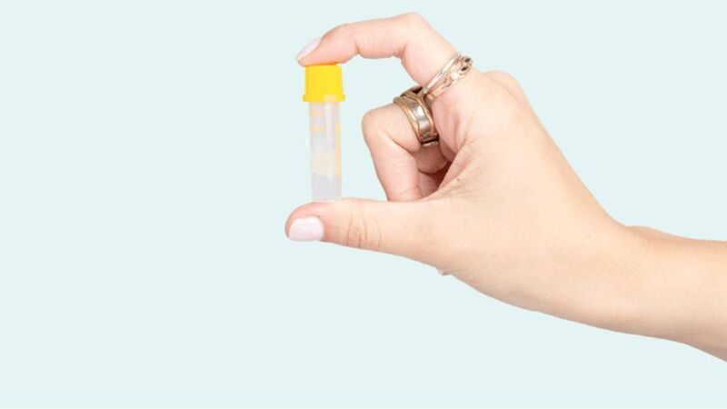 Significant rise in STIs being reported in Cork and Kerry