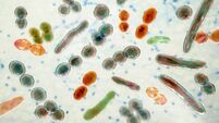 Travelling community have gut microbiome to protect from inflammatory disorders - UCC research
