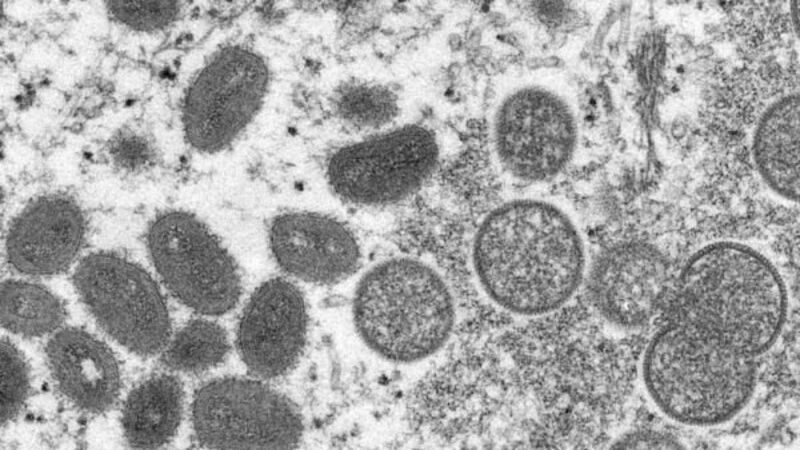 Government should tackle threat of monkeypox 'head on', says HIV Ireland