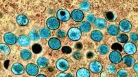 Vaccination advice for groups most at risk of monkeypox to be issued soon