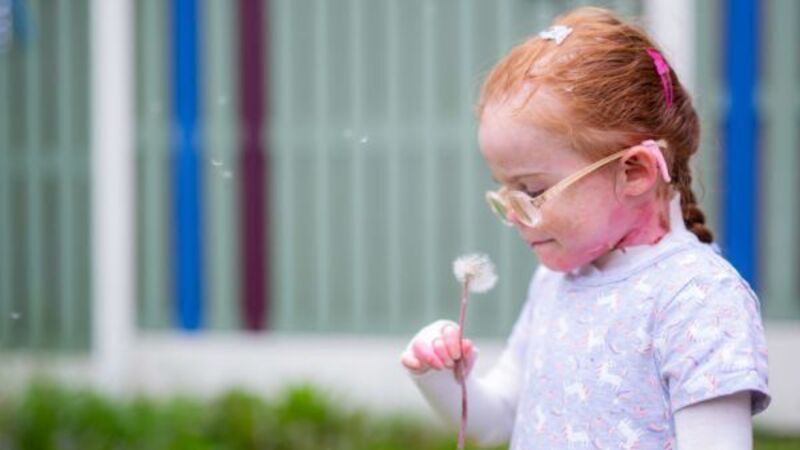 Girl with rare skin disease stars in book explaining disorder to classmates Girl with rare skin disease stars in book explaining disorder to classmates