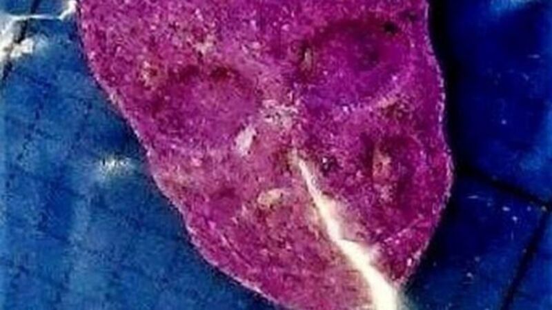 Electric Picnic drug warning after double strength ecstasy found