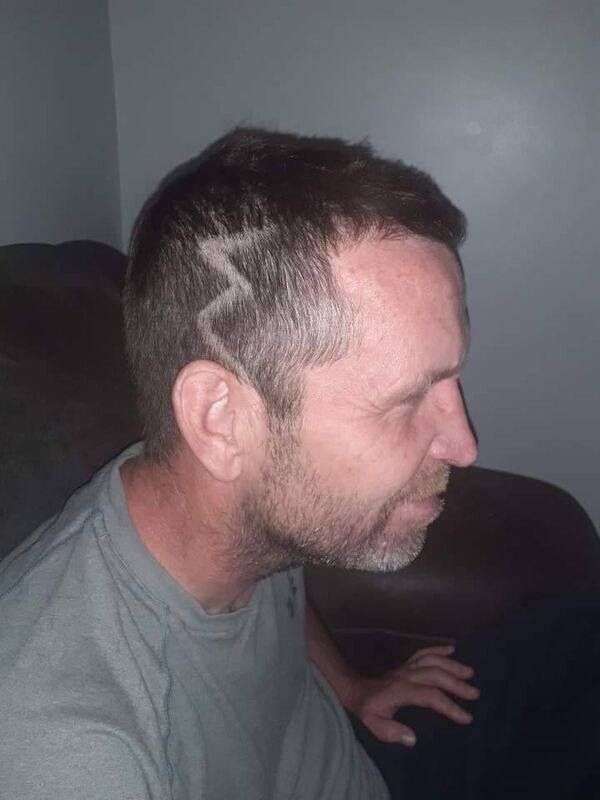 His dad Terence got his head shaved in the shape of Kye's scar, to show him support, when he was being bullied by others. His dad Terence got his head shaved in the shape of Kye's scar, to show him support, when he was being bullied by others.