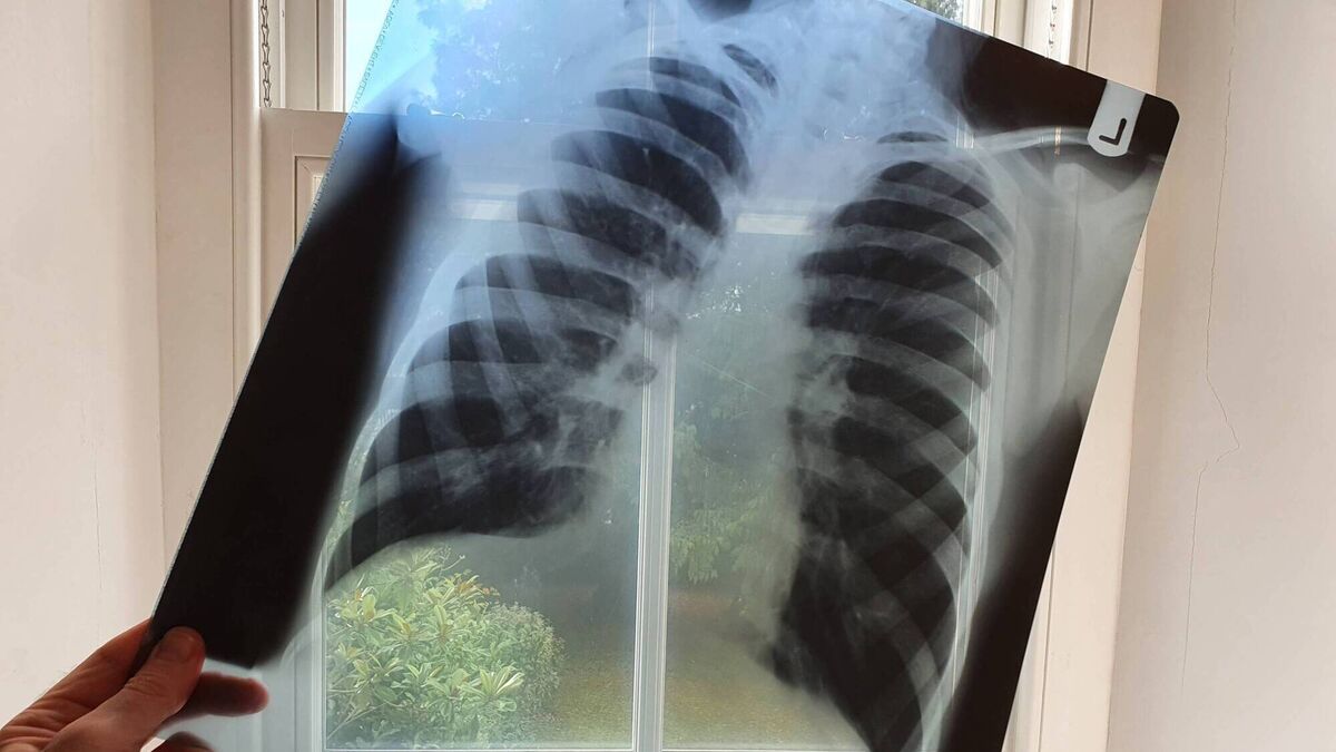 1,500 deaths due to COPD every year