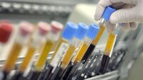 Israeli Laboratory Leads Western World In Blood Testing