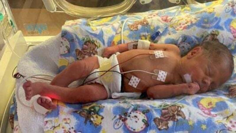 Father embarks on marathon effort to raise funds for neo-natal facilities Father embarks on marathon effort to raise funds for neo-natal facilities
