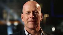 Bruce Willis diagnosed with dementia