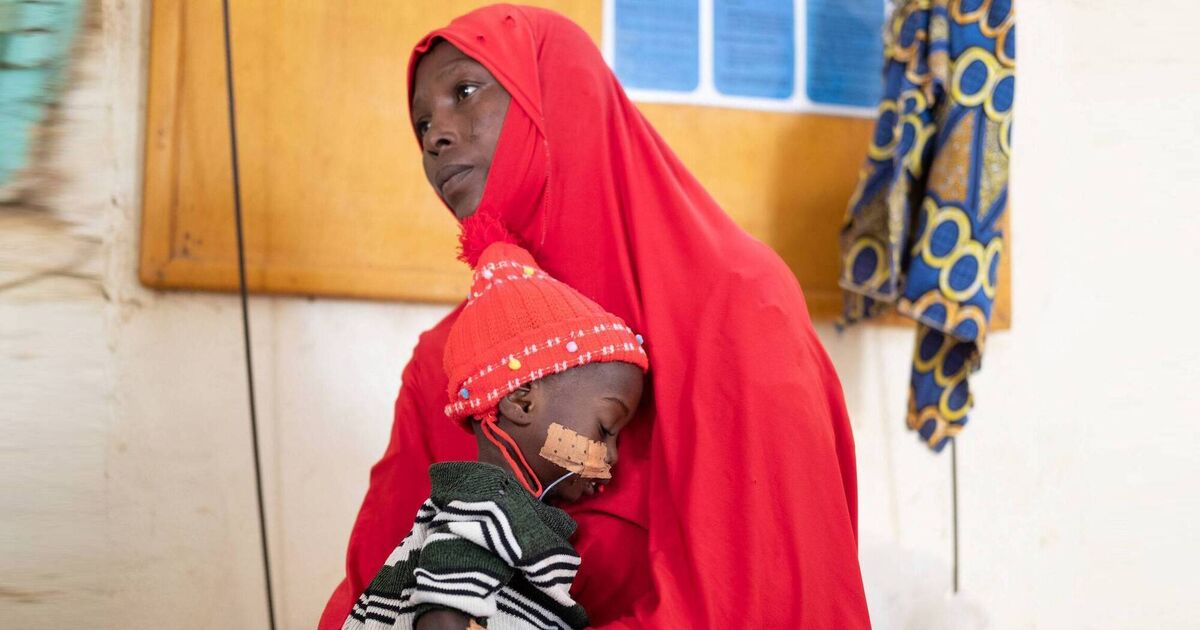 "We're not just putting a band aid on things, we're solving the root causes of malnutrition" - Vimarsana News