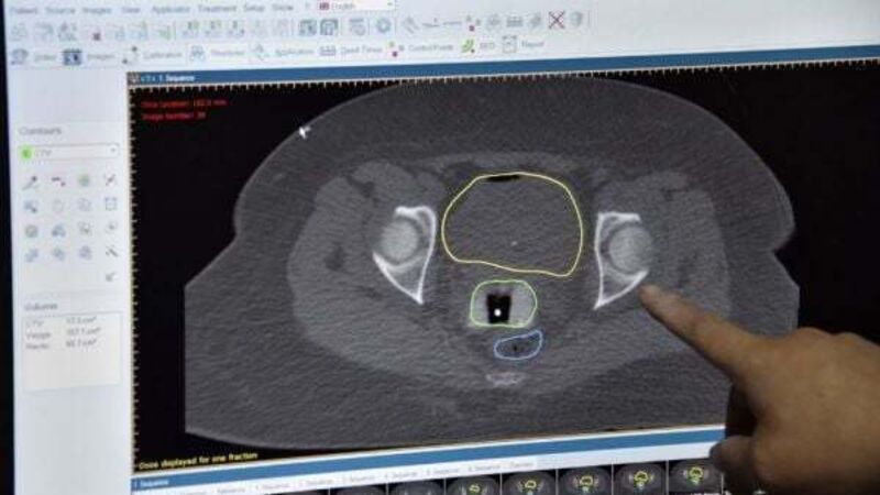 Over 380 claims brought against CervicalCheck programme