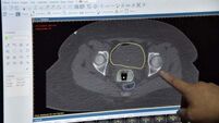 Over 380 claims brought against CervicalCheck programme