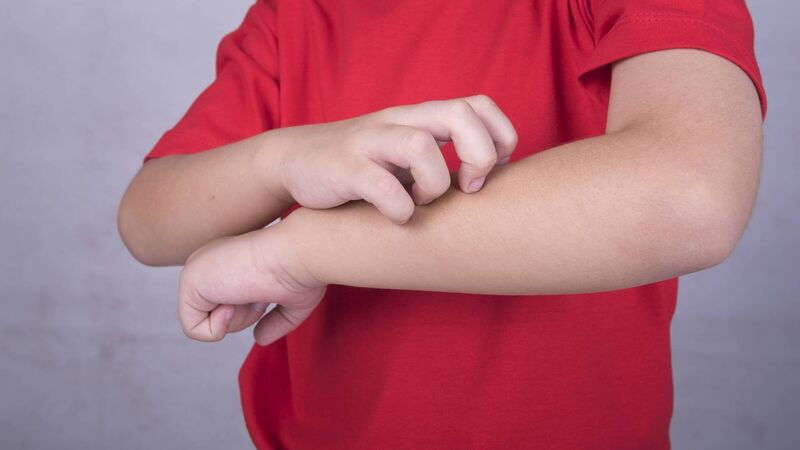 Back to basics to create good management of childhood eczema