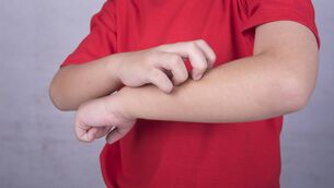 <p>Eczema is an inflammatory reaction that leads to dry, red and itchy skin. Picture: Stock</p>