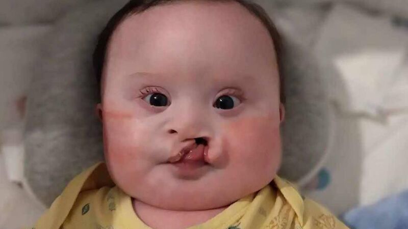 Cork mum: We nearly lost Nickey three times, he’s our little warrior