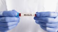 Measles Blood Test