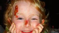 'I wish I didn’t need to have my bandages changed on Christmas Day,' Cork schoolgirl with painful skin condition says