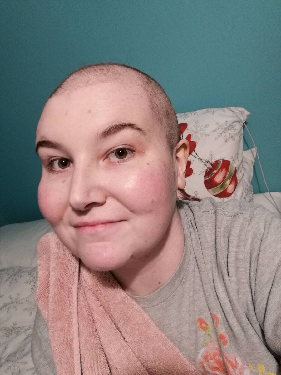Megan Dalton Rafferty after her first round of chemo.