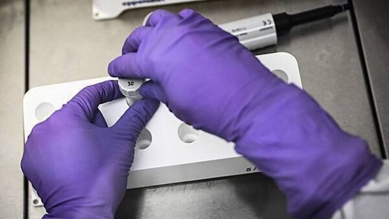 New research could be 'overstating' link between Parkinson's and pesticides, neurologist says New research could be 'overstating' link between Parkinson's and pesticides, neurologist says