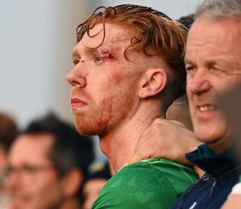 A bloodied and bruised Limerick captain Cian Lynch watching the penalties. Picture: Eddie O'Hare