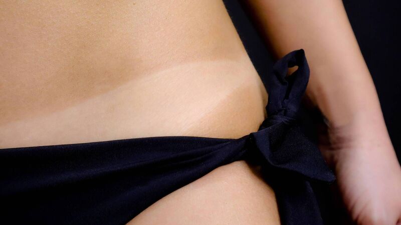 Cork tanning firm seeks alternative to outright sunbed ban