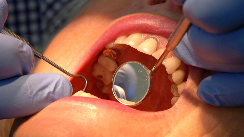 Cork TD slams theatre closures amid long waits for dental treatment