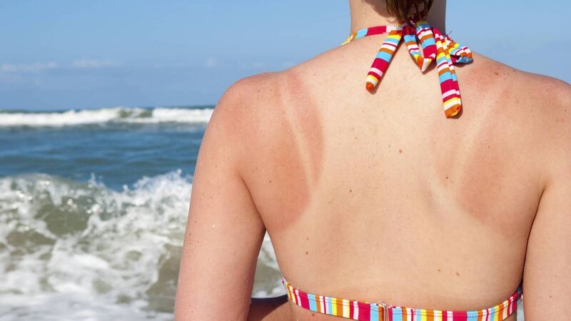How to reverse signs of sun damage How to reverse signs of sun damage