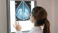Unrecognizable female gynocologist looking at a mammogram at the hospital