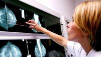 Dr Michelle O'Driscoll: Importance of getting to know your breasts