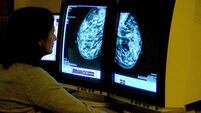 Breast cancer study