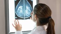 Unrecognizable female gynocologist looking at a mammogram at the hospital